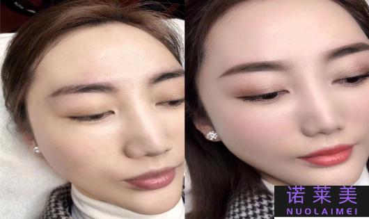 眼唇在哪个位置图片
