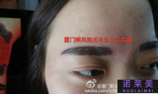 植眉和绣眉哪个好