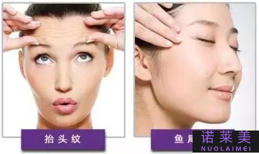 打botox到哪个医院好